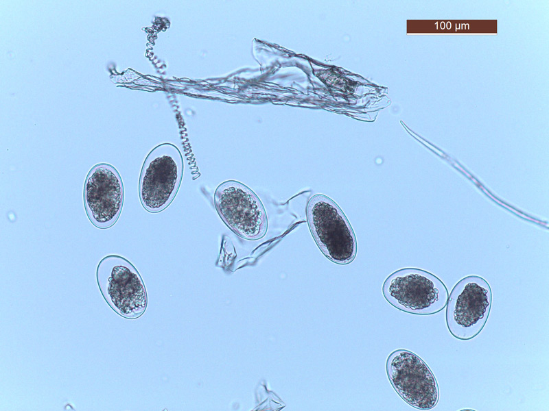 Helminthes intestinaux. Giardia parasite size